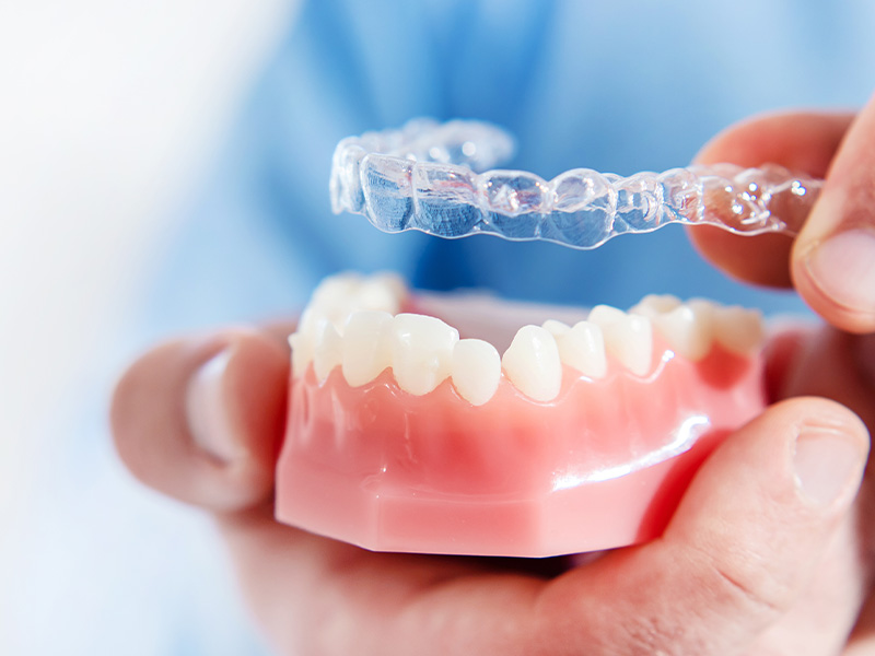 マウスピース矯正による幅広い症例への対応