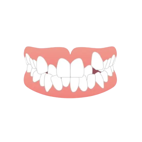 叢生（そうせい）